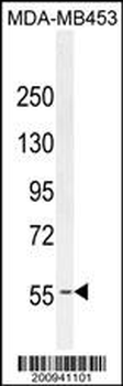 ESR1 Antibody