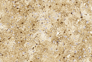 GFAP Antibody
