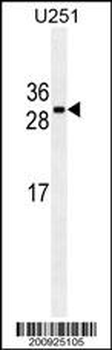 CDCA8 Antibody