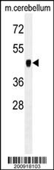 PDK2 Antibody