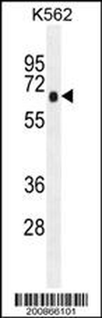 PRKAA1 Antibody