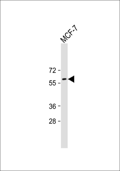AFP Antibody (N-term)
