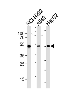 ALDH2 Antibody