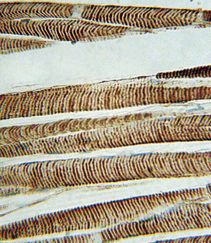 Beta-Actin Antibody