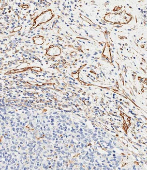 CD34 Antibody (Center)