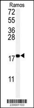 UBC9 Antibody
