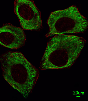 TBB5 Antibody