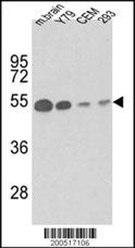 TBB1 Antibody