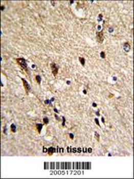TBB1 Antibody
