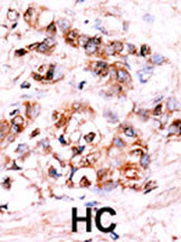 DUSP15 Antibody (N-term)