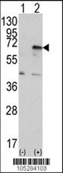 PKR (PRKR) Antibody (C-term)