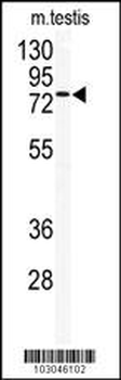 TLK2 Antibody (Center)