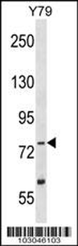 TLK2 Antibody (Center)