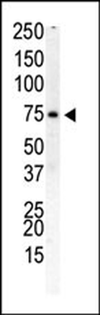 PIP5K1B Antibody (N-term)