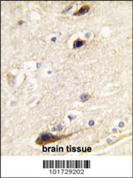 PIP5K1B Antibody (N-term)
