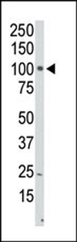 PI4KCB Antibody (N-term)