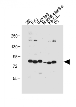 cGKI (cGKI beta) Antibody (C-term)