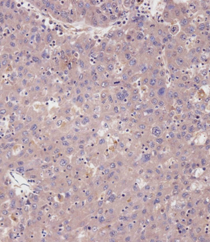 cGKI (cGKI beta) Antibody (C-term)