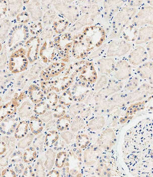 MUC20 Antibody (C-term)