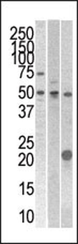 STYK1 Antibody (N-term)