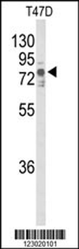 TNK1 Antibody