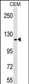 KIT Antibody (Y721)