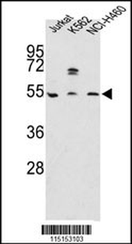 APOA4 Antibody (N-term)