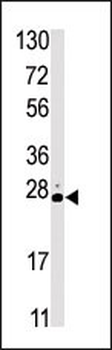 STK19 Antibody (C-term)