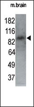 MARK1 Antibody (N-term)