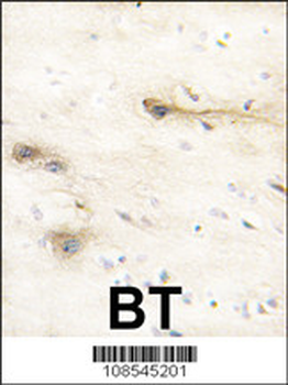MARK1 Antibody (N-term)