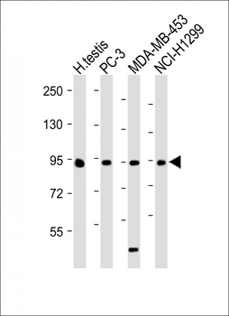 BRDT Antibody (N-term)