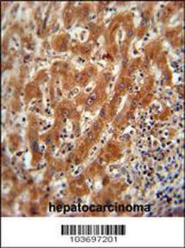 Pyruvate Kinase (PKM2) Antibody (C-term)