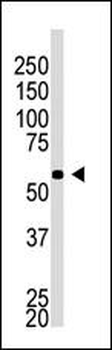 BACE2C Antibody (C-term)