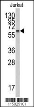 CYP26A1 Antibody (Center)