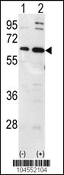 Ubiquilin1 Antibody (N-term)