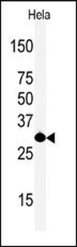 ASCL1 (Achaete-scute homolog 1) Antibody (C-term D220)