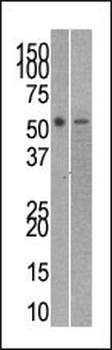 Reptin/TIP49B/RUVB2 Antibody (C-term)