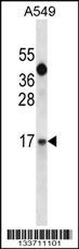 IGF1 Antibody (C-term)