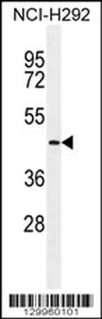 TMPRSS11E2 Antibody (Center)