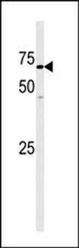 GAK Antibody (N-term)