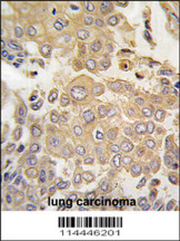 MAPK4 Antibody (N-term)