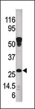 ABAD Antibody (C-term)