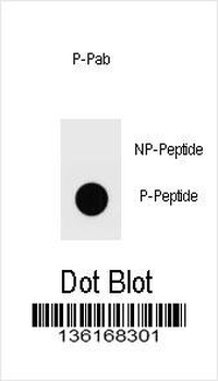 Phospho-Ammonium transporter(T465) Antibody
