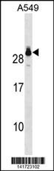 GSTT2 Antibody(Center)