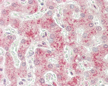 GSTT2 Antibody(Center)