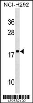RPS17L Antibody (Center)
