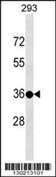 TSPY3 Antibody (C-term)