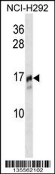 TRAPPC2 Antibody (N-term)