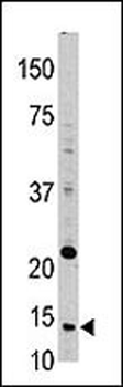 Thioredoxin (TRX) Antibody (N-term)