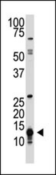 D SUMO Antibody (C-term)